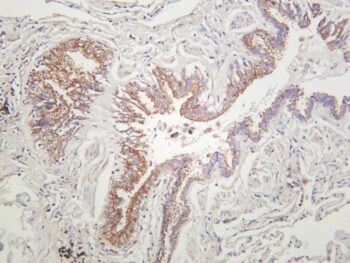 MEK1/2 Rabbit Monoclonal Antibody - Image 2
