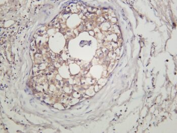 IKK α/β Rabbit Monoclonal Antibody - Image 2