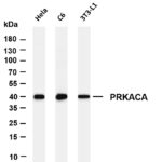 PRKACA Rabbit Monoclonal Antibody