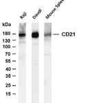 CD21 Rabbit Monoclonal Antibody