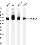 ACSL4 Rabbit Monoclonal Antibody