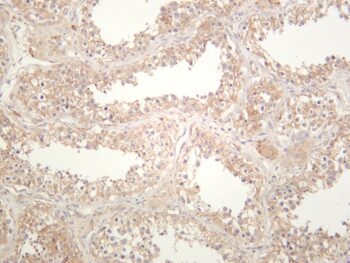 Notch2 Rabbit Monoclonal Antibody - Image 2