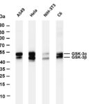 GSK3 α/β Rabbit Monoclonal Antibody
