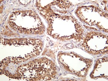 GSK3 α/β Rabbit Monoclonal Antibody - Image 2
