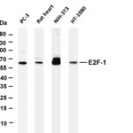 E2F-1 Rabbit Monoclonal Antibody