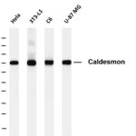 Caldesmon Rabbit Monoclonal Antibody