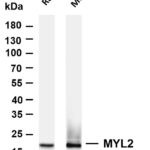 MYL2 Rabbit Monoclonal Antibody