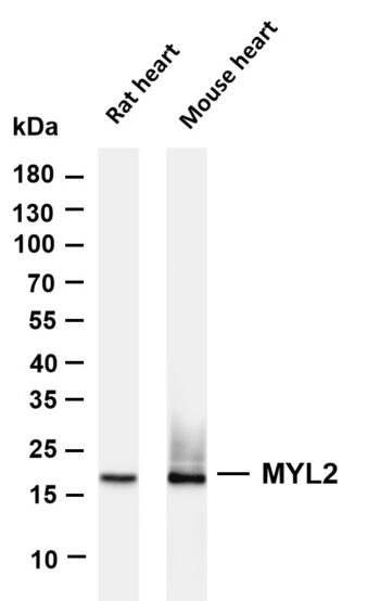 MYL2 Rabbit Monoclonal Antibody