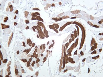 MYL2 Rabbit Monoclonal Antibody - Image 2