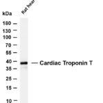 Cardiac Troponin T Rabbit Monoclonal Antibody