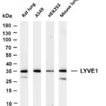 LYVE1 Rabbit Monoclonal Antibody