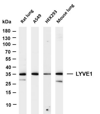 LYVE1 Rabbit Monoclonal Antibody
