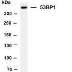 53BP1 Rabbit Monoclonal Antibody
