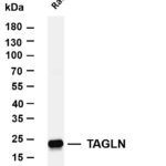 TAGLN Rabbit Monoclonal Antibody