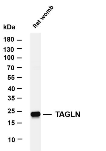 TAGLN Rabbit Monoclonal Antibody