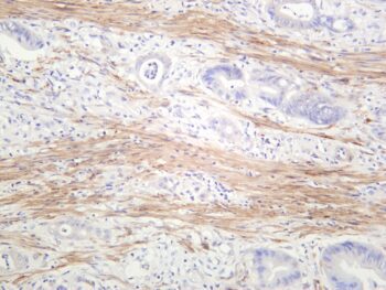 TAGLN Rabbit Monoclonal Antibody - Image 2