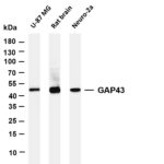 GAP43 Rabbit Monoclonal Antibody