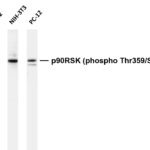 p90RSK (Phospho-Thr359/Ser363) Rabbit Monoclonal Antibody