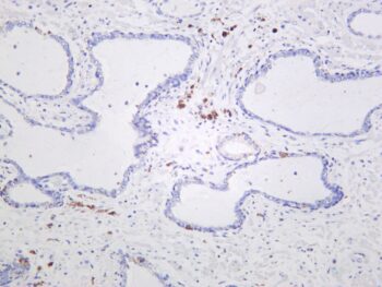 Keap1 Rabbit Monoclonal Antibody - Image 2