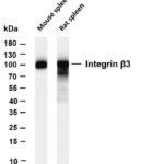 Integrin β3 Rabbit Monoclonal Antibody