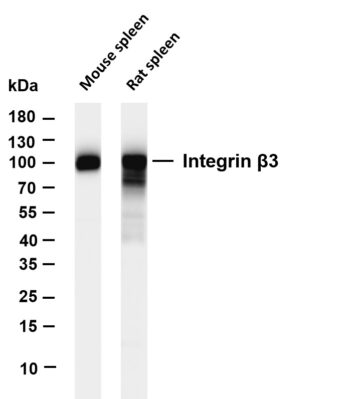 Integrin β3 Rabbit Monoclonal Antibody