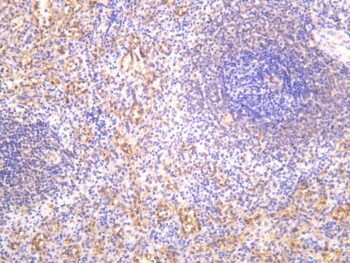 Integrin β3 Rabbit Monoclonal Antibody - Image 2