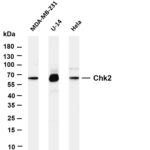 Chk2 Rabbit Monoclonal Antibody