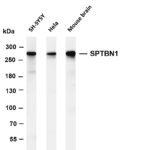 SPTBN1 Rabbit Monoclonal Antibody
