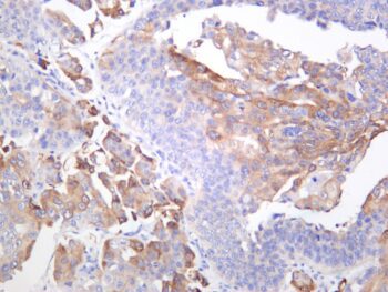 Ezrin Rabbit Monoclonal Antibody - Image 2