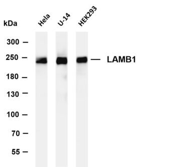 LAMB1 Rabbit Monoclonal Antibody