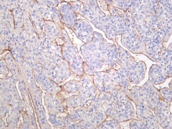 LAMB1 Rabbit Monoclonal Antibody - Image 2