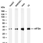 eIF2α Rabbit Monoclonal Antibody