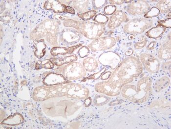 OCLN Rabbit Monoclonal Antibody - Image 2