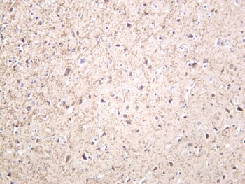 Amyloid-β Rabbit Monoclonal Antibody - Image 2