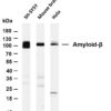 Amyloid-β Rabbit Monoclonal Antibody