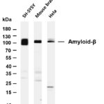 Amyloid-β Rabbit Monoclonal Antibody
