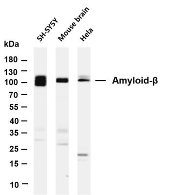 Amyloid-β Rabbit Monoclonal Antibody