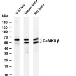 CaMKII β Rabbit Monoclonal Antibody