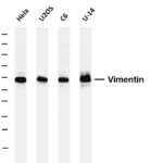 Vimentin Rabbit Monoclonal Antibody
