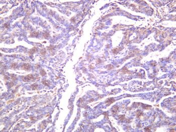 mTOR (Phospho-Ser2448) Rabbit Monoclonal Antibody - Image 2