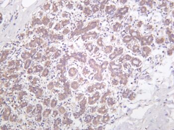 IKK α Rabbit Monoclonal Antibody - Image 2