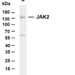 JAK2 Rabbit Monoclonal Antibody