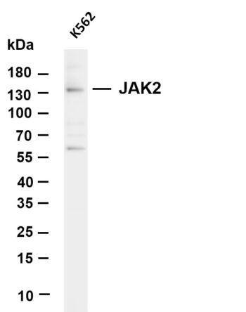 JAK2 Rabbit Monoclonal Antibody