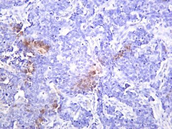 JAK2 Rabbit Monoclonal Antibody - Image 2