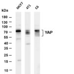 YAP Rabbit Monoclonal Antibody