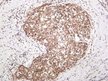 ERK1/2 Rabbit Monoclonal Antibody - Image 2