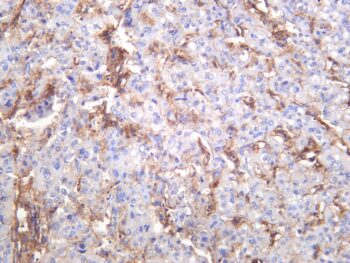 Integrin β1 Rabbit Monoclonal Antibody - Image 4