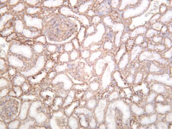 Integrin β1 Rabbit Monoclonal Antibody - Image 3