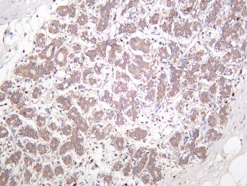 mTOR Rabbit Monoclonal Antibody - Image 2