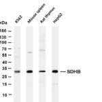 SDHB Rabbit Monoclonal Antibody